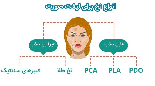 لیفت صورت با نخ در اصفهان