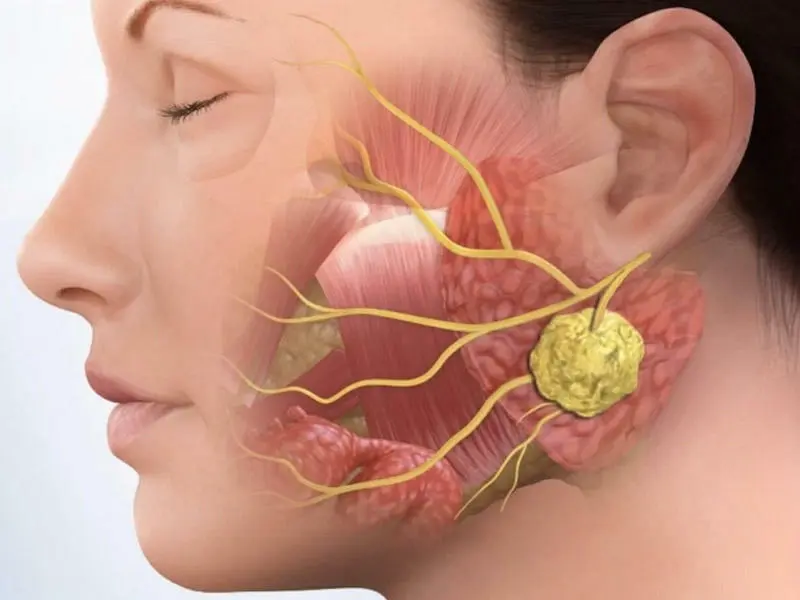 بوکال فت در اصفهان