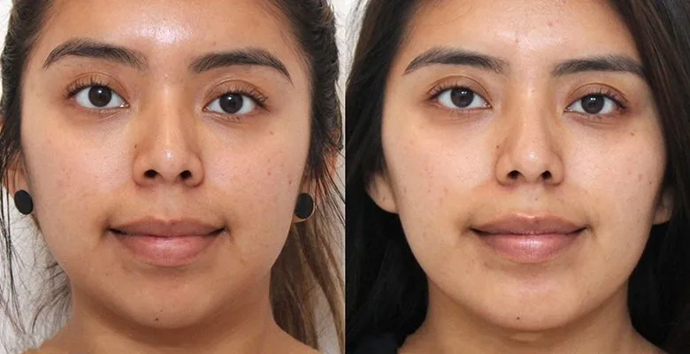 بوکال فت در اصفهان