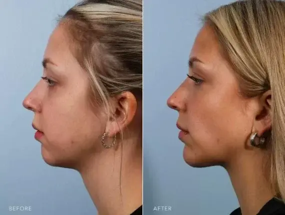 بوکال فت در اصفهان