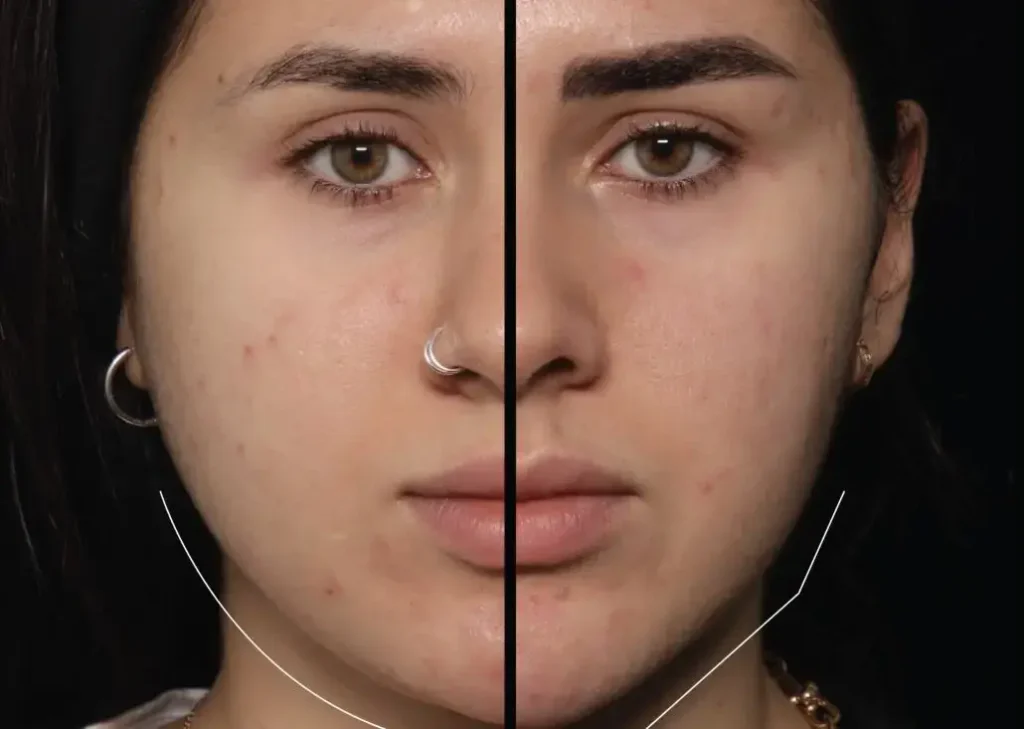 بوکال فت در اصفهان