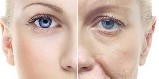 جوانسازی پوست در اصفهان