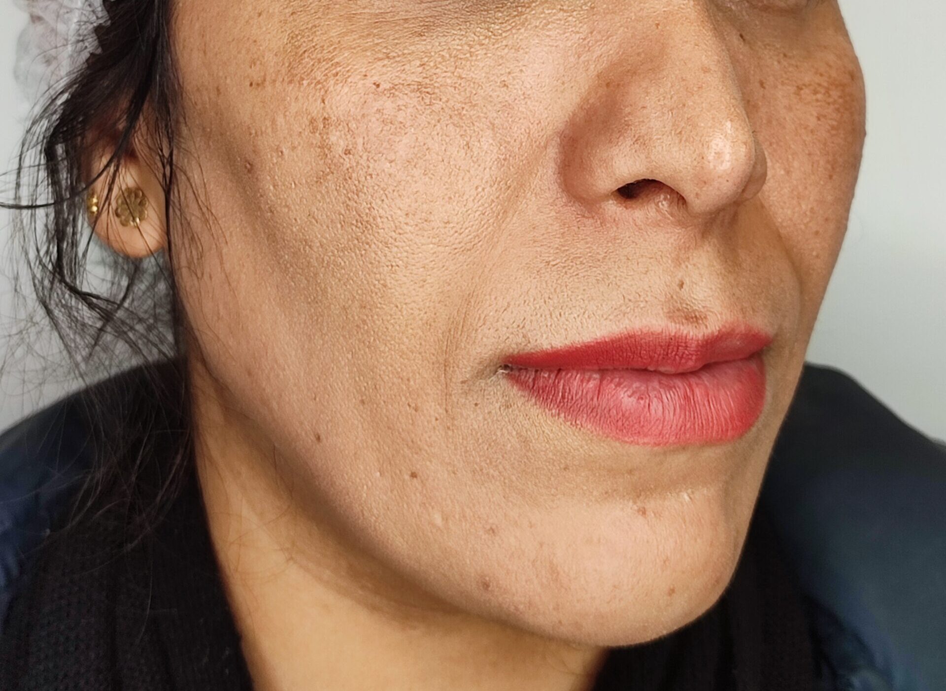 رفع خط لبحند