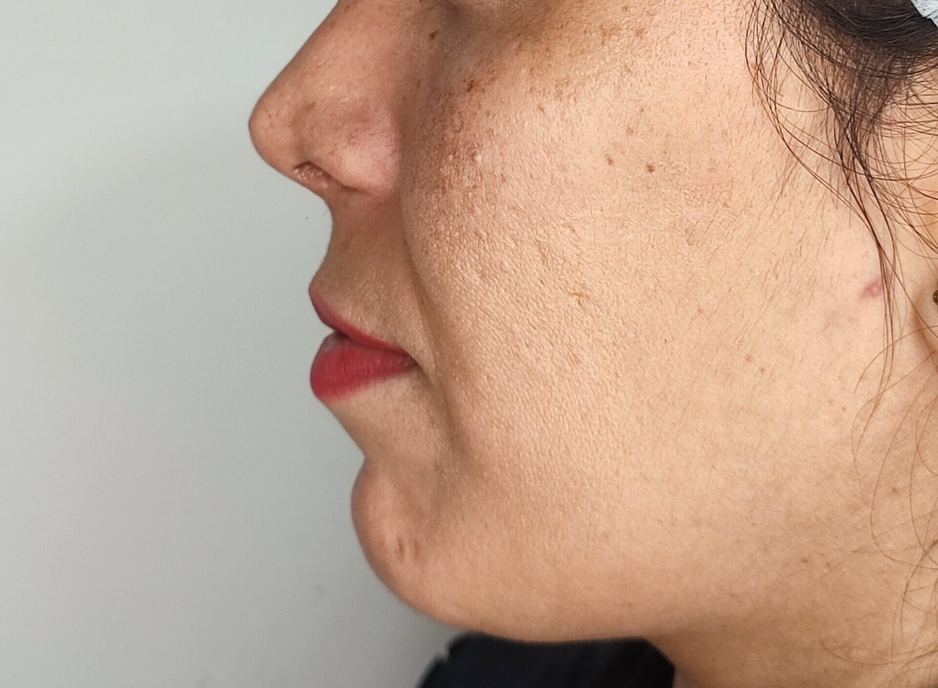 رفع خط لبحند