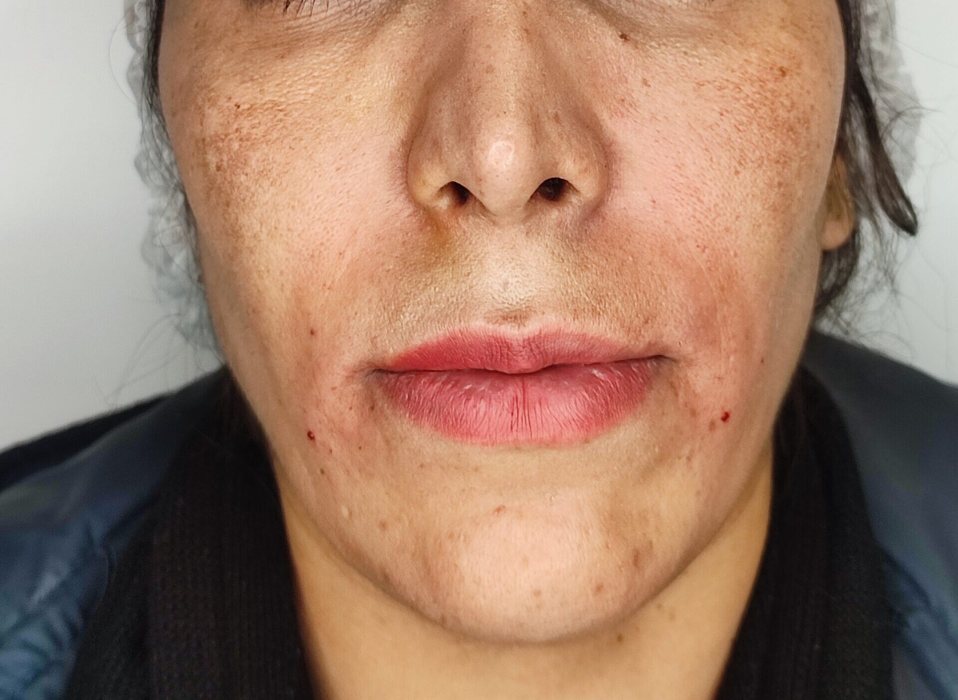 رفع خط لبحند