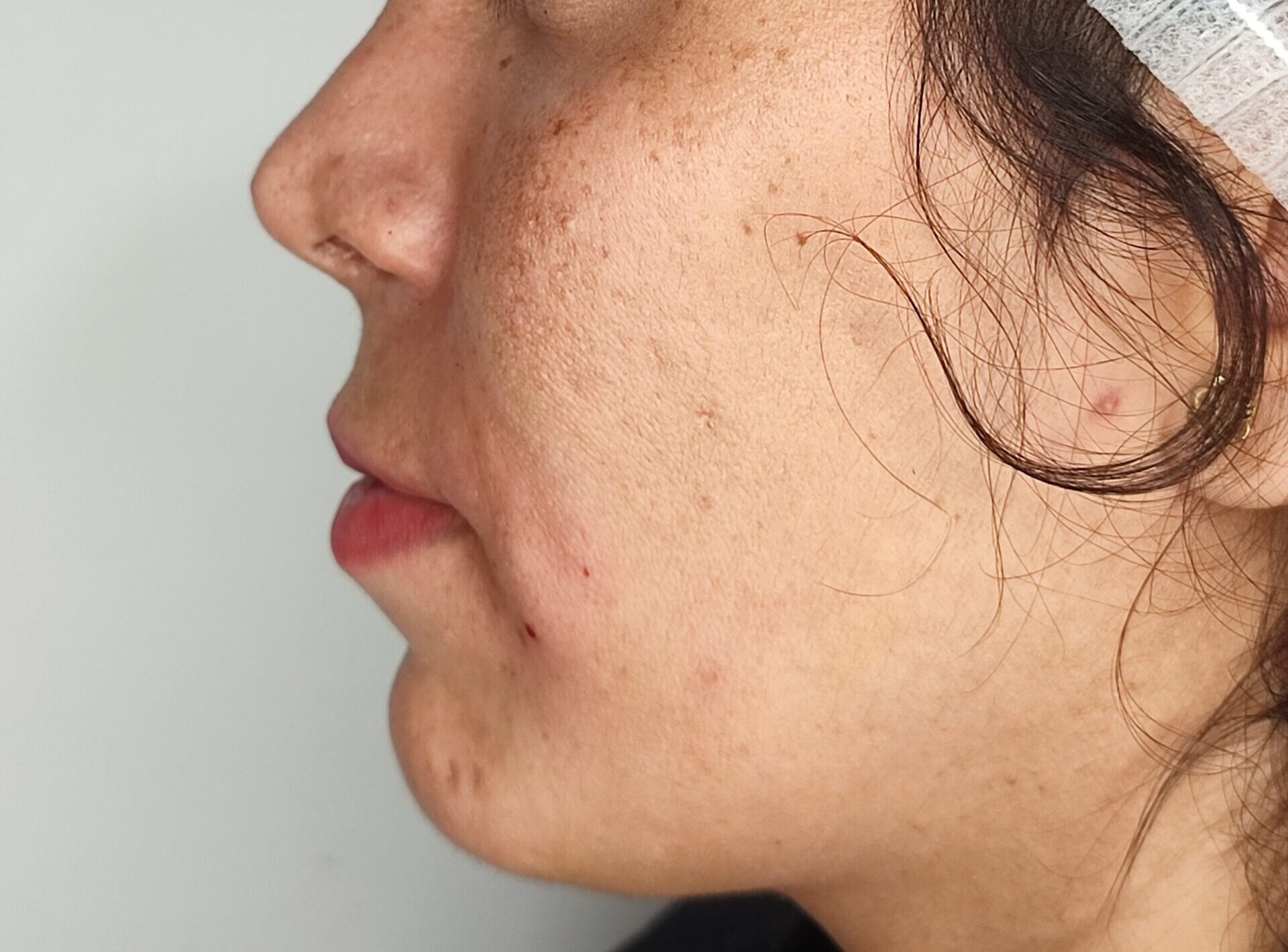 رفع خط لبحند