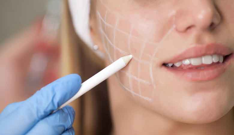 آیا جراحی بوکال فت باعث پیری می شود؟