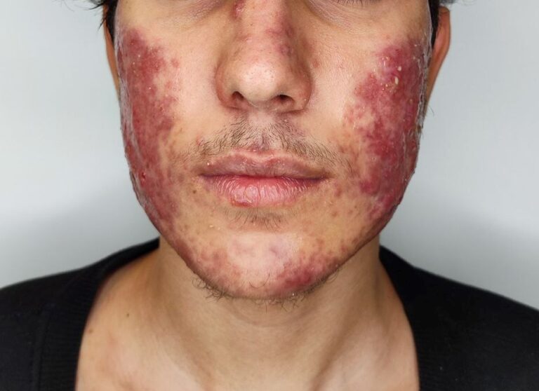نمومه کار دکتر سپیده سعادتی
