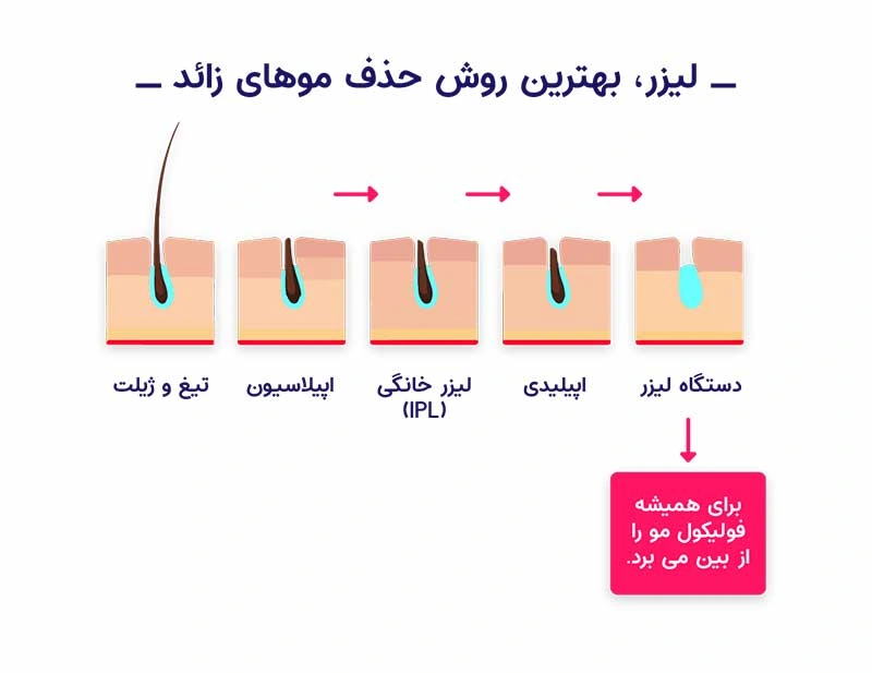 بیشتر بخوانید:جوانسازی پوست در اصفهان