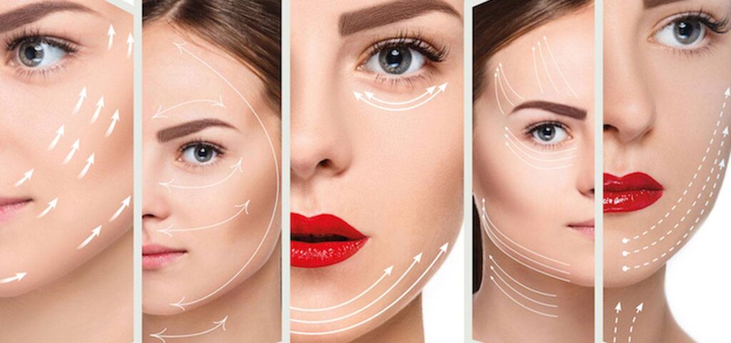 لیفت صورت با نخ در شاهین شهر