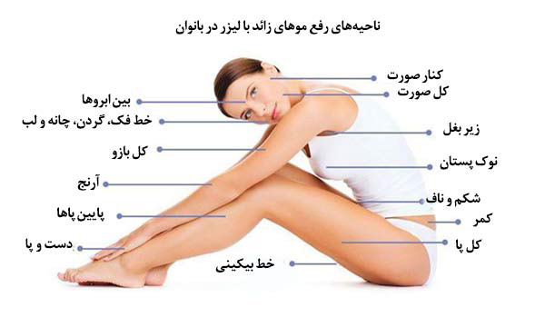 لیزر موهای زائد در شاهین شهر