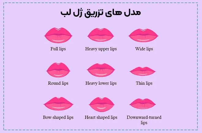 تزریق ژل لب در شاهین شهر