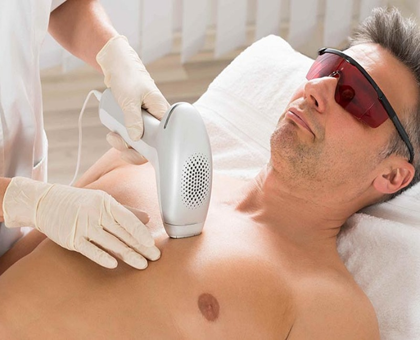 لیزر موهای زائد برای چه کسانی ضرر دارد