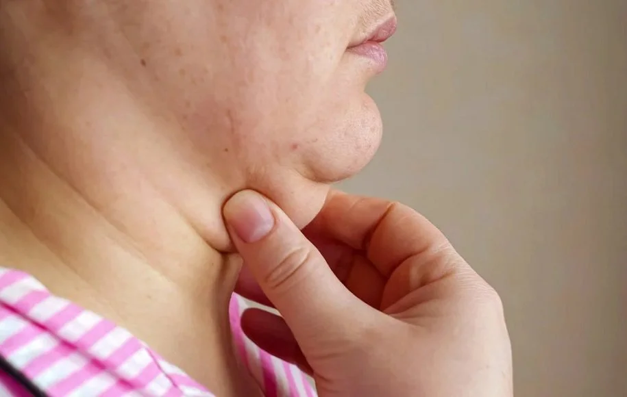 نحوه خوابیدن بعد از ساکشن غبغب