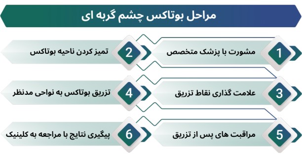 بوتاکس چشم گربه ای در اصفهان