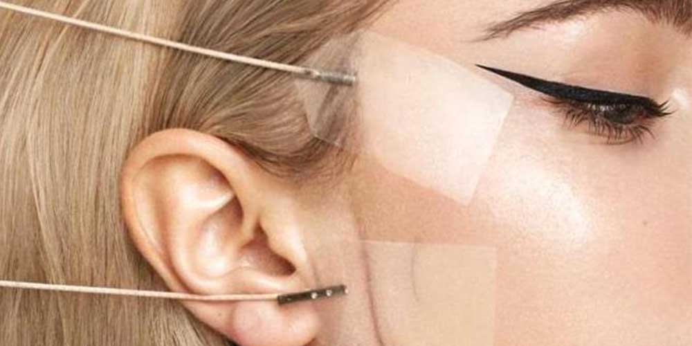 چسب زدن بعد از لیفت با نخ