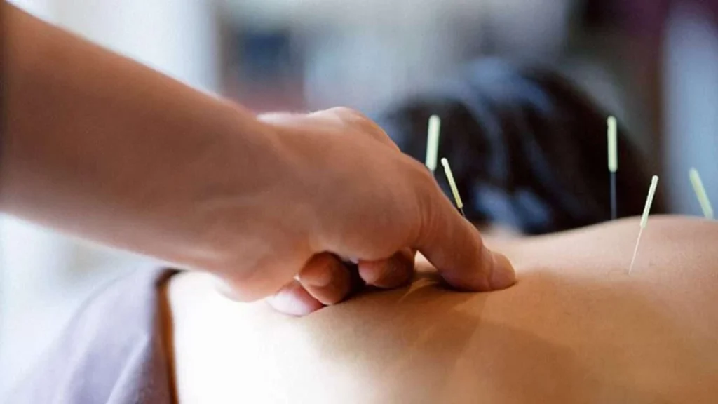 کاشت نخ لاغری در اصفهان