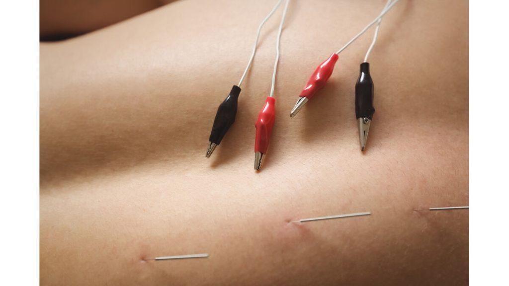 عوارض امبدینگ شکم