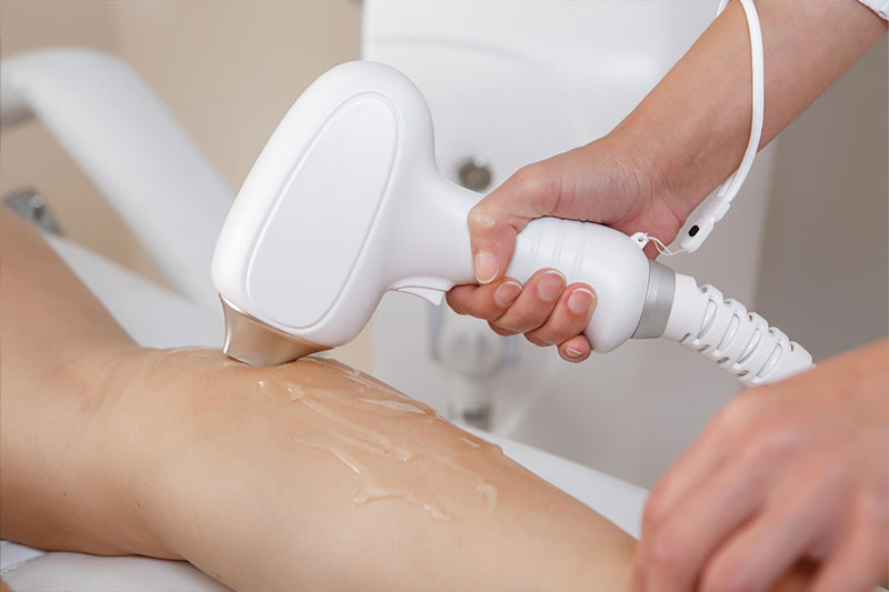 لیزر موهای زائد با ژل بهتر است یا بدون ژل