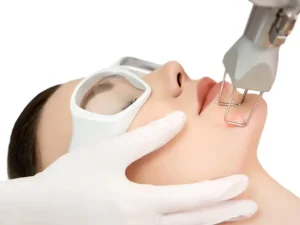 لیزر جای جوش چند جلسه طول میکشد؟