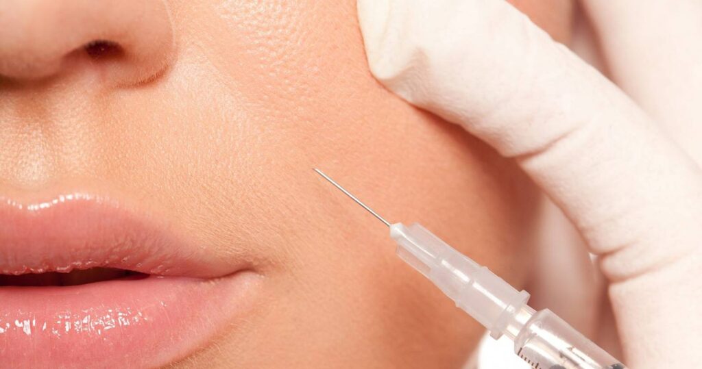 تزریق فیلر خط خنده در اصفهان