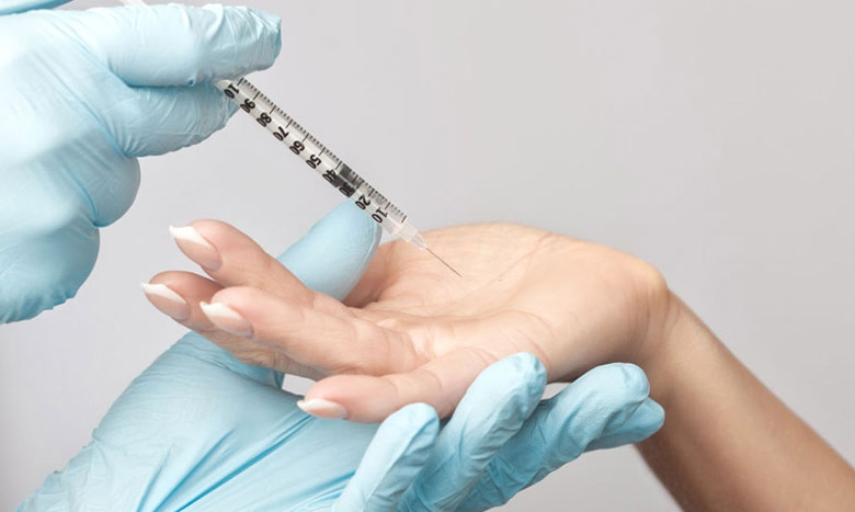 تزریق بوتاکس کف دست در اصفهان