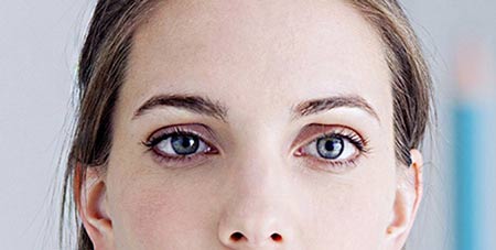 تزریق بوتاکس برای انحراف چشم