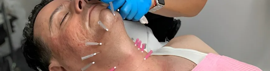 لیفت غبغب با نخ