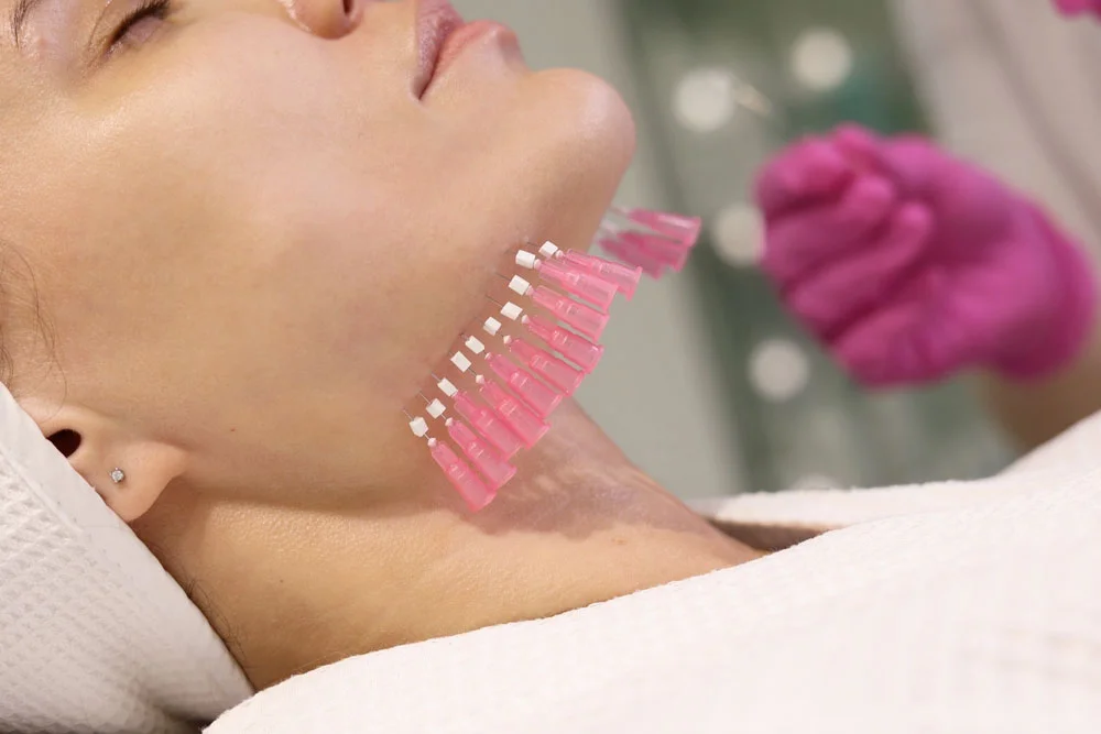 لیفت غبغب با نخ