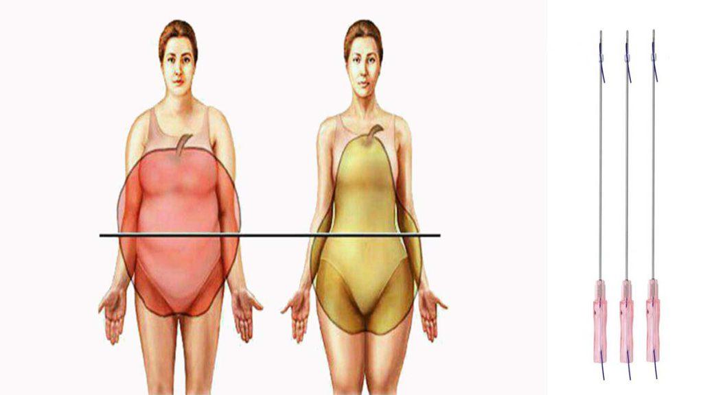 اثر نخ امبدینگ در لاغری موضعی و کاهش سلولیت