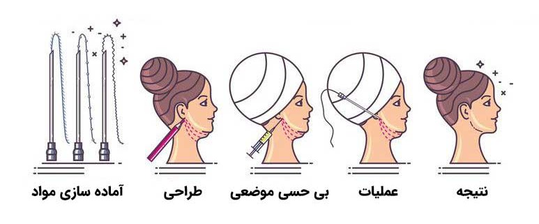 راهنمای کامل لیفت صورت با نخ
