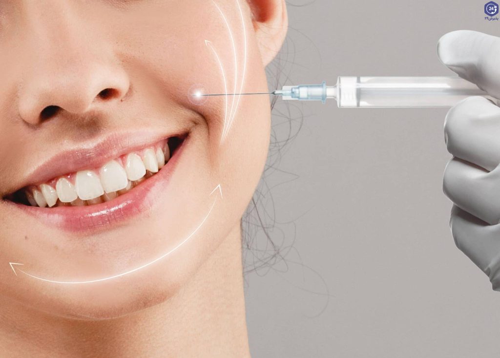 برای خط خنده ژل بهتره یا فیلر؟