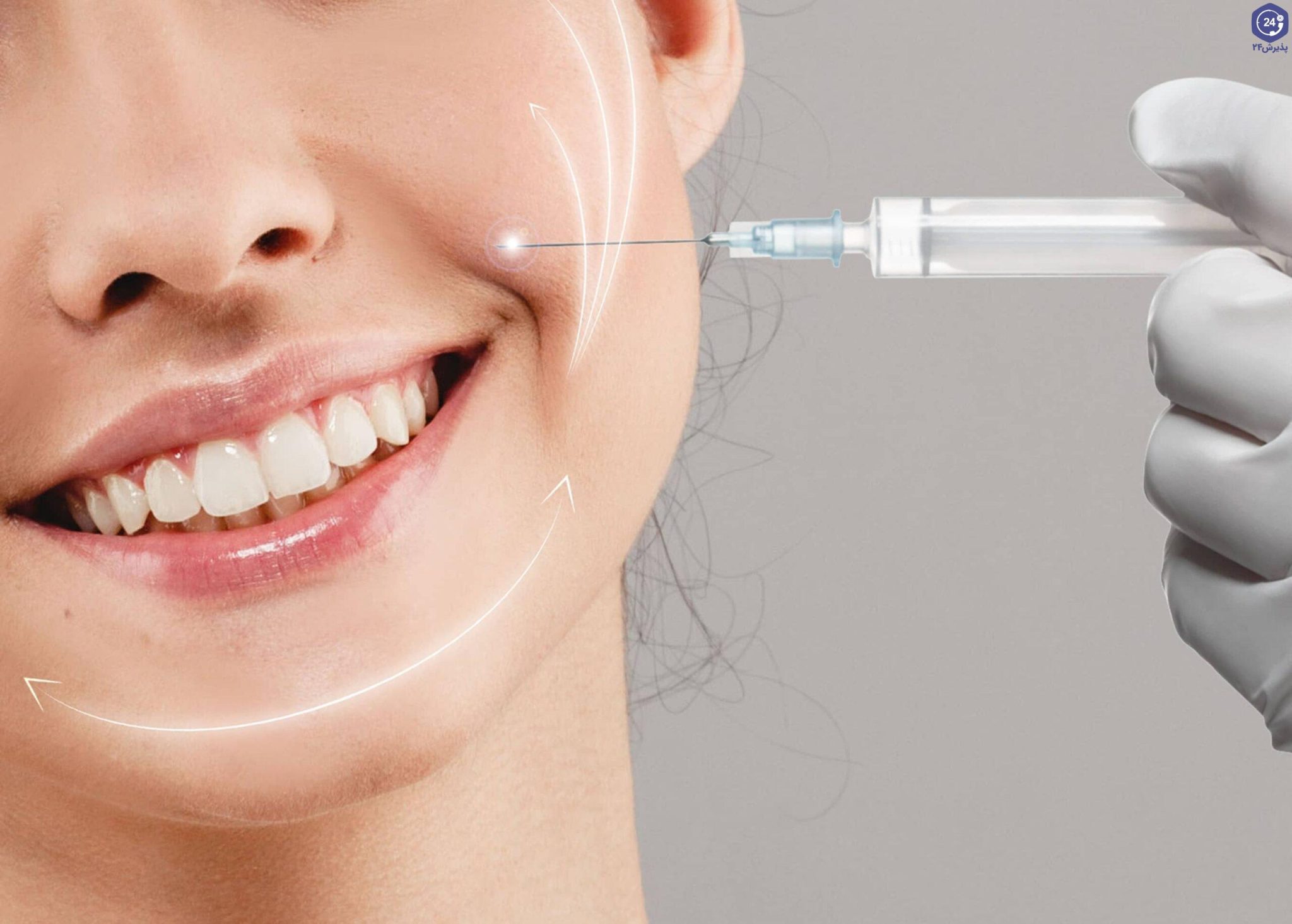 برای خط خنده ژل بهتره یا فیلر؟